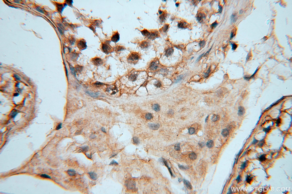 IHC staining of human testis using 18323-1-AP