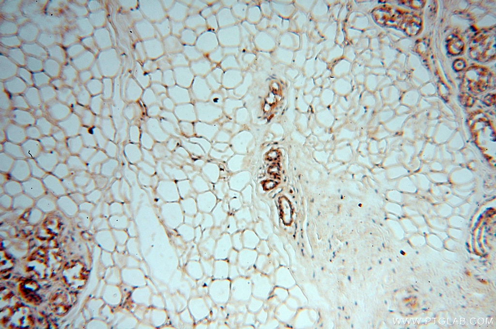 Immunohistochemistry (IHC) staining of human skin tissue using DEAF1 Polyclonal antibody (18323-1-AP)
