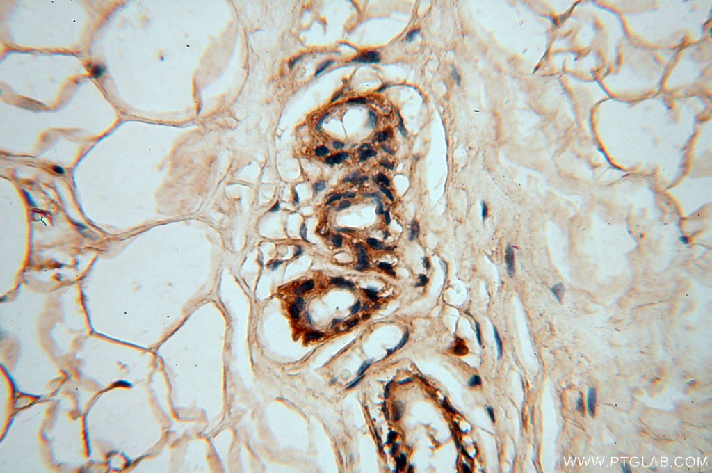 Immunohistochemistry (IHC) staining of human skin tissue using DEAF1 Polyclonal antibody (18323-1-AP)