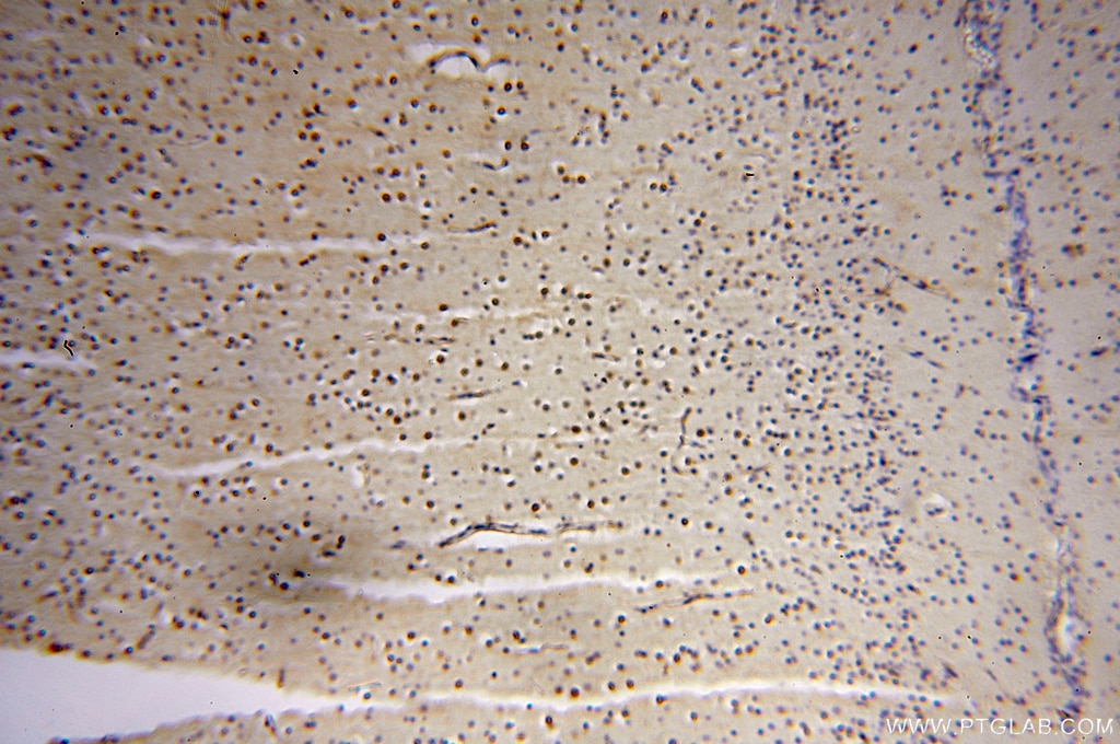 Immunohistochemistry (IHC) staining of human brain tissue using DEAF1 Polyclonal antibody (18323-1-AP)