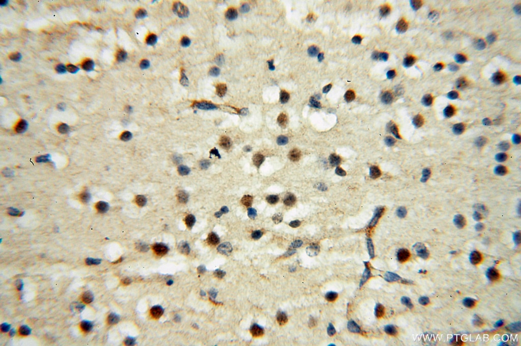 Immunohistochemistry (IHC) staining of human brain tissue using DEAF1 Polyclonal antibody (18323-1-AP)