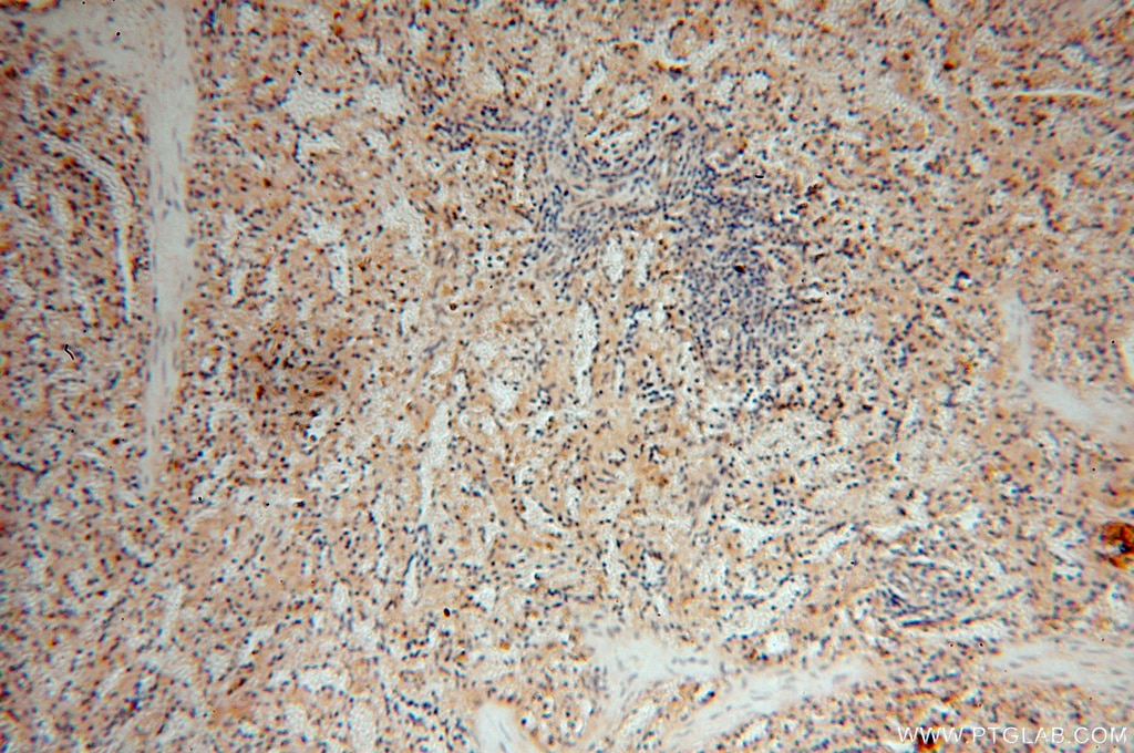 Immunohistochemistry (IHC) staining of human spleen tissue using DEAF1 Polyclonal antibody (18323-1-AP)