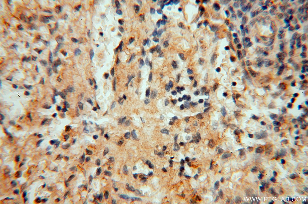 Immunohistochemistry (IHC) staining of human spleen tissue using DEAF1 Polyclonal antibody (18323-1-AP)