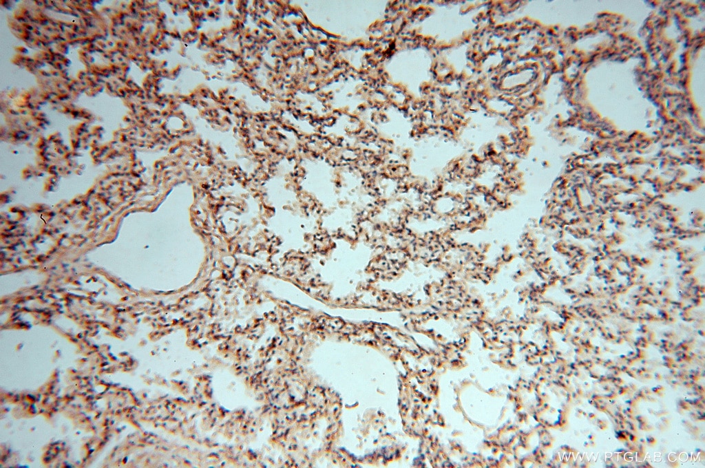 Immunohistochemistry (IHC) staining of human lung tissue using DEAF1 Polyclonal antibody (18323-1-AP)