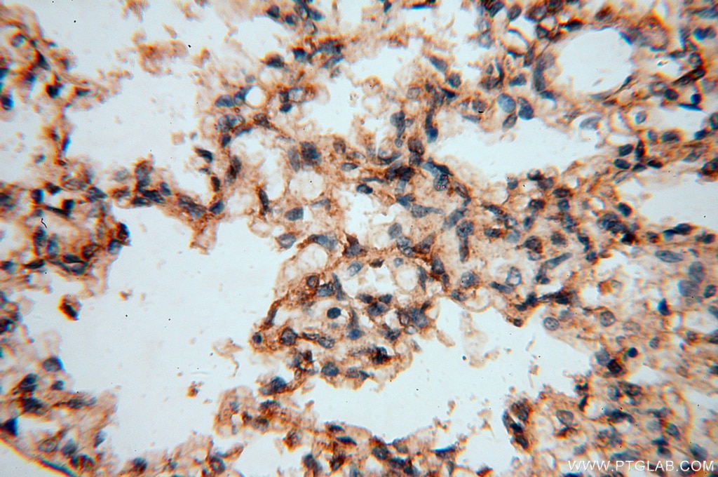 Immunohistochemistry (IHC) staining of human lung tissue using DEAF1 Polyclonal antibody (18323-1-AP)