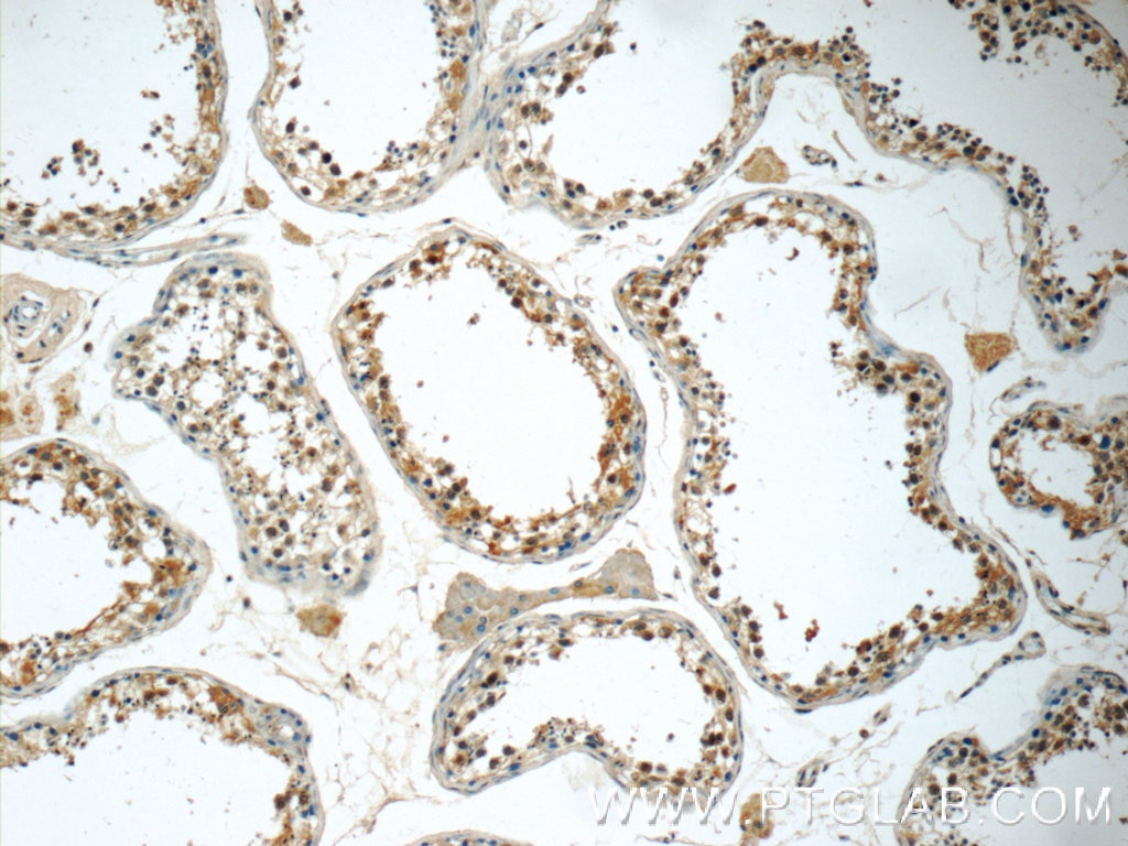 Immunohistochemistry (IHC) staining of human testis tissue using DEC1 Polyclonal antibody (25021-1-AP)