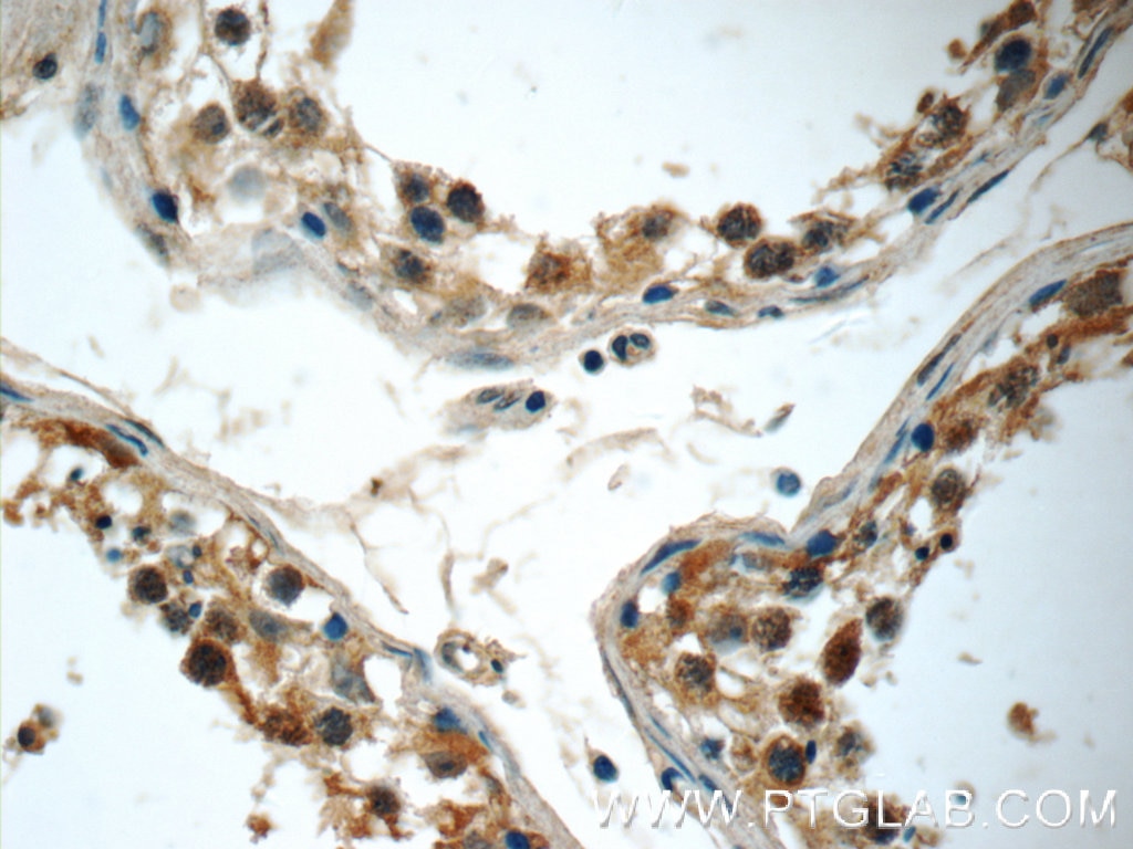 Immunohistochemistry (IHC) staining of human testis tissue using DEC1 Polyclonal antibody (25021-1-AP)