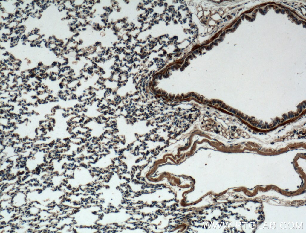 Immunohistochemistry (IHC) staining of mouse lung tissue using DECR2 Polyclonal antibody (25855-1-AP)