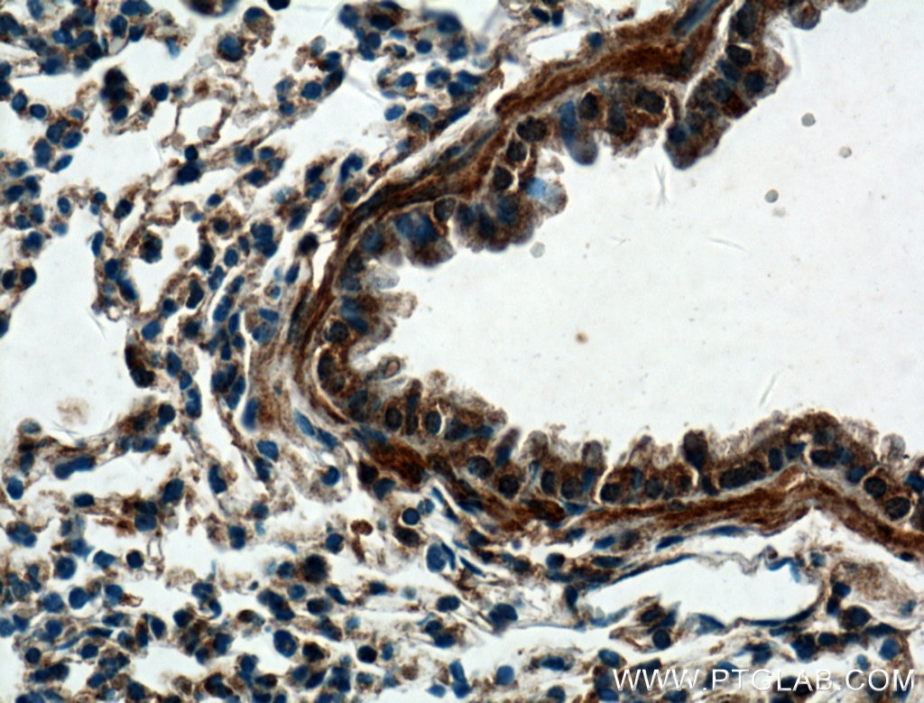 Immunohistochemistry (IHC) staining of mouse lung tissue using DECR2 Polyclonal antibody (25855-1-AP)
