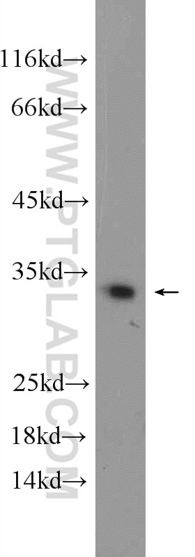 Western Blot (WB) analysis of mouse lung tissue using DECR2 Polyclonal antibody (25855-1-AP)
