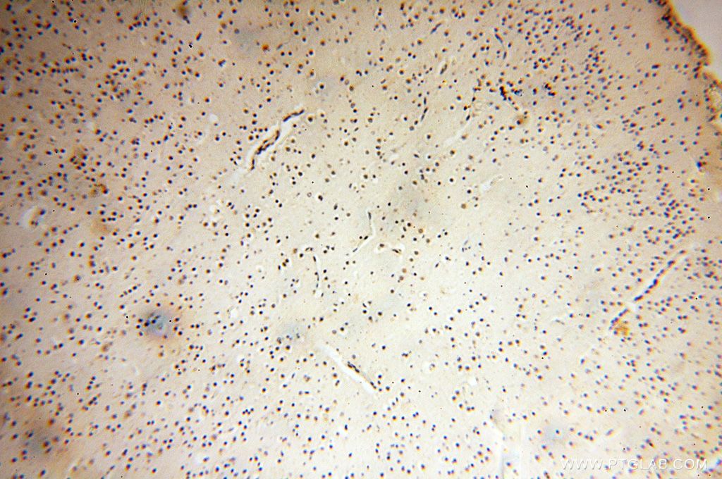 Immunohistochemistry (IHC) staining of human brain tissue using DEDD2 Polyclonal antibody (14574-1-AP)