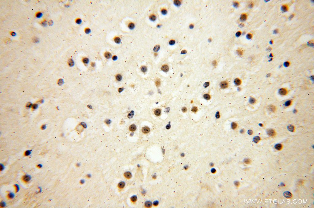 Immunohistochemistry (IHC) staining of human brain tissue using DEDD2 Polyclonal antibody (14574-1-AP)