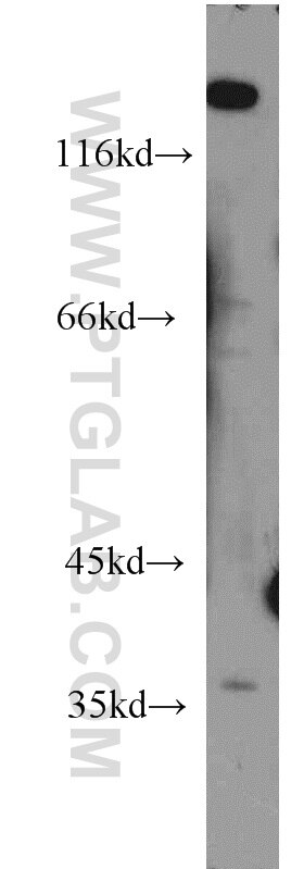 Western Blot (WB) analysis of HEK-293 cells using DEDD2 Polyclonal antibody (14574-1-AP)