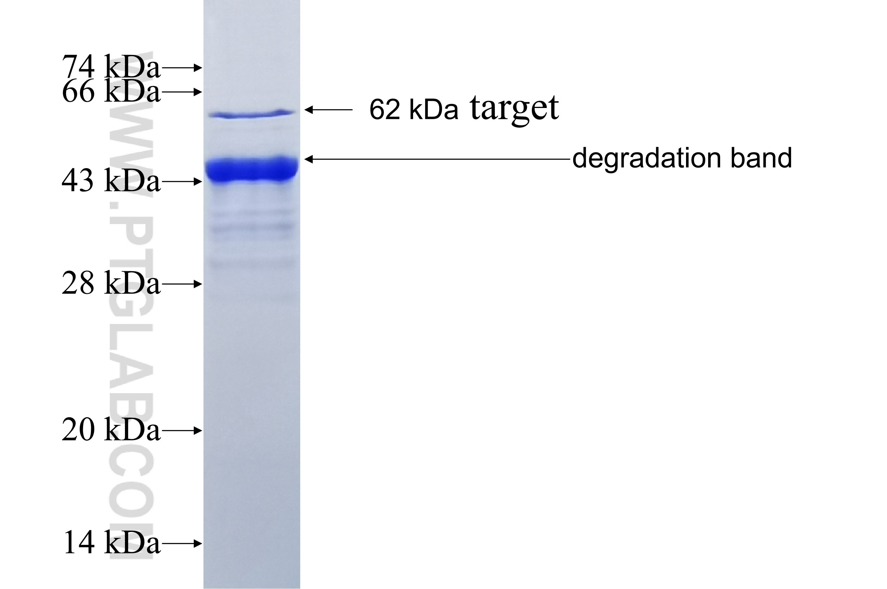 DEDD2 fusion protein Ag43010 SDS-PAGE