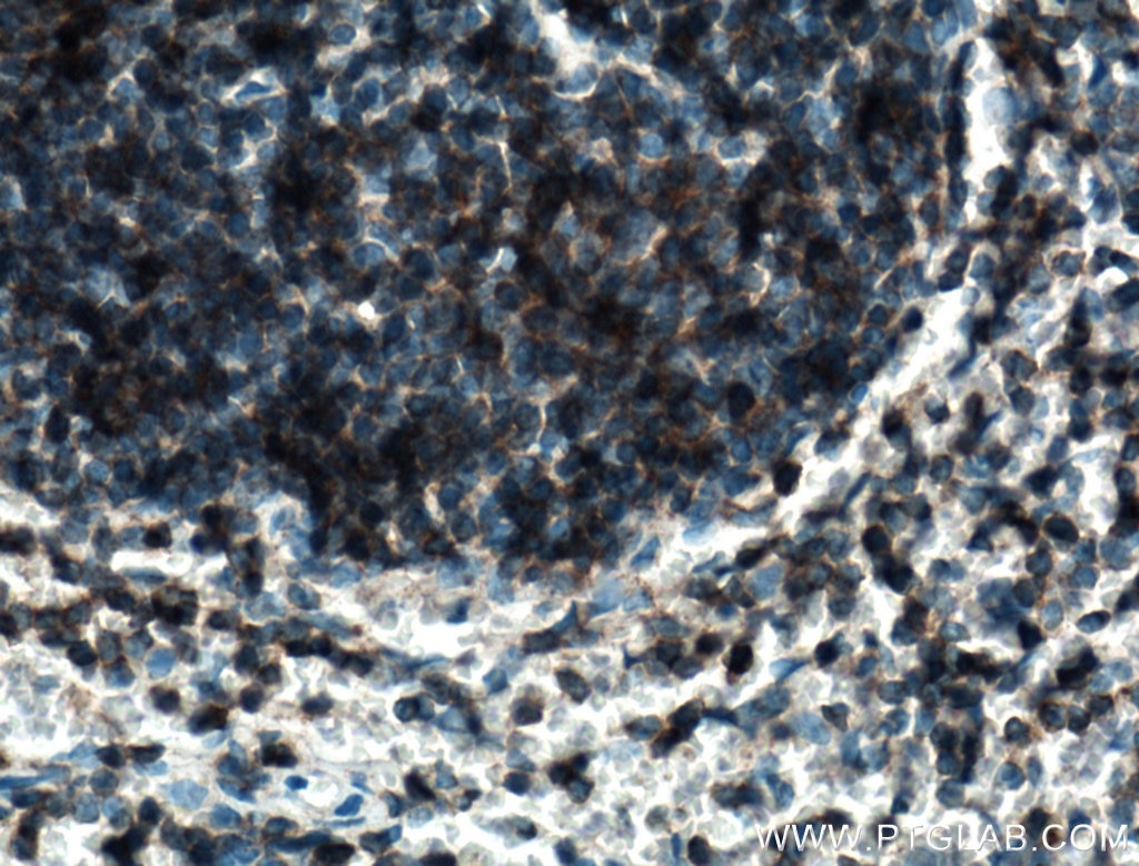 Immunohistochemistry (IHC) staining of mouse spleen tissue using DEF6 Polyclonal antibody (11369-1-AP)