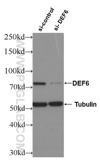 Western Blot (WB) analysis of Jurkat cells using DEF6 Polyclonal antibody (11369-1-AP)