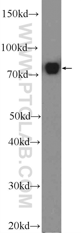 Western Blot (WB) analysis of Jurkat cells using DEF6 Polyclonal antibody (11369-1-AP)