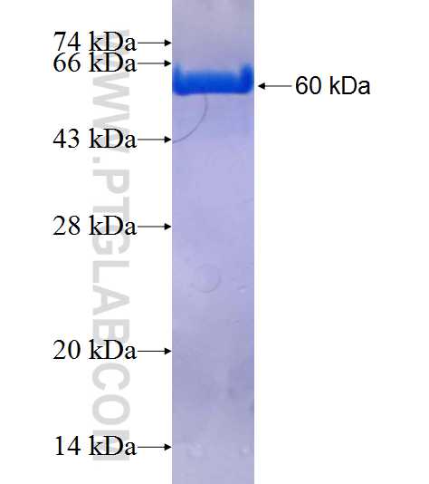 DEF6 fusion protein Ag1925 SDS-PAGE