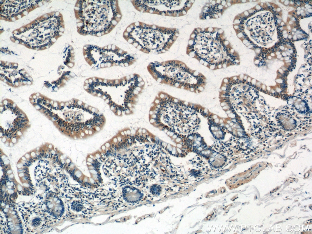 Immunohistochemistry (IHC) staining of human small intestine tissue using DEFA1 Polyclonal antibody (18057-1-AP)