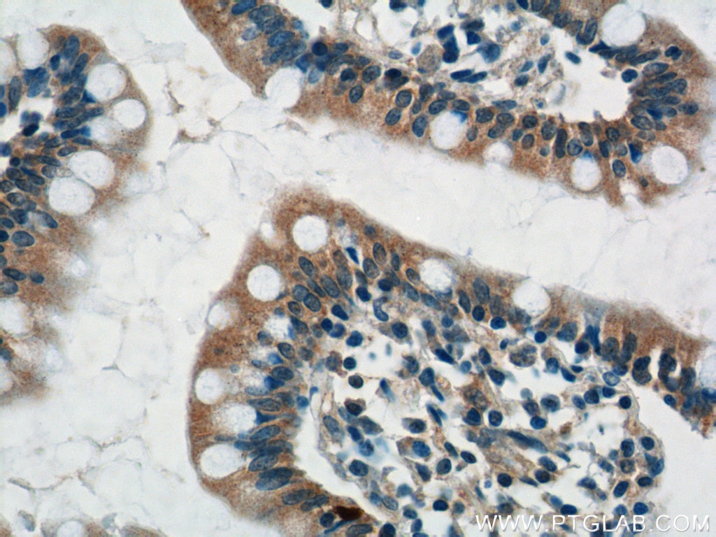Immunohistochemistry (IHC) staining of human small intestine tissue using DEFA1 Polyclonal antibody (18057-1-AP)