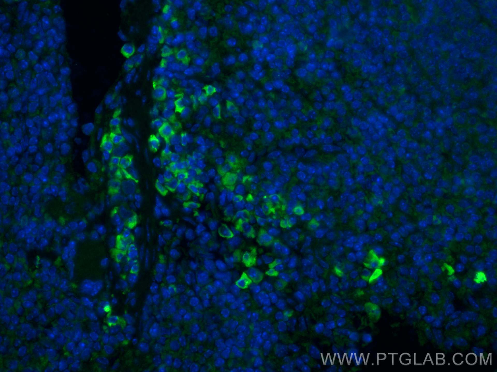 Immunofluorescence (IF) / fluorescent staining of mouse spleen tissue using DEFA1 Monoclonal antibody (67156-1-Ig)