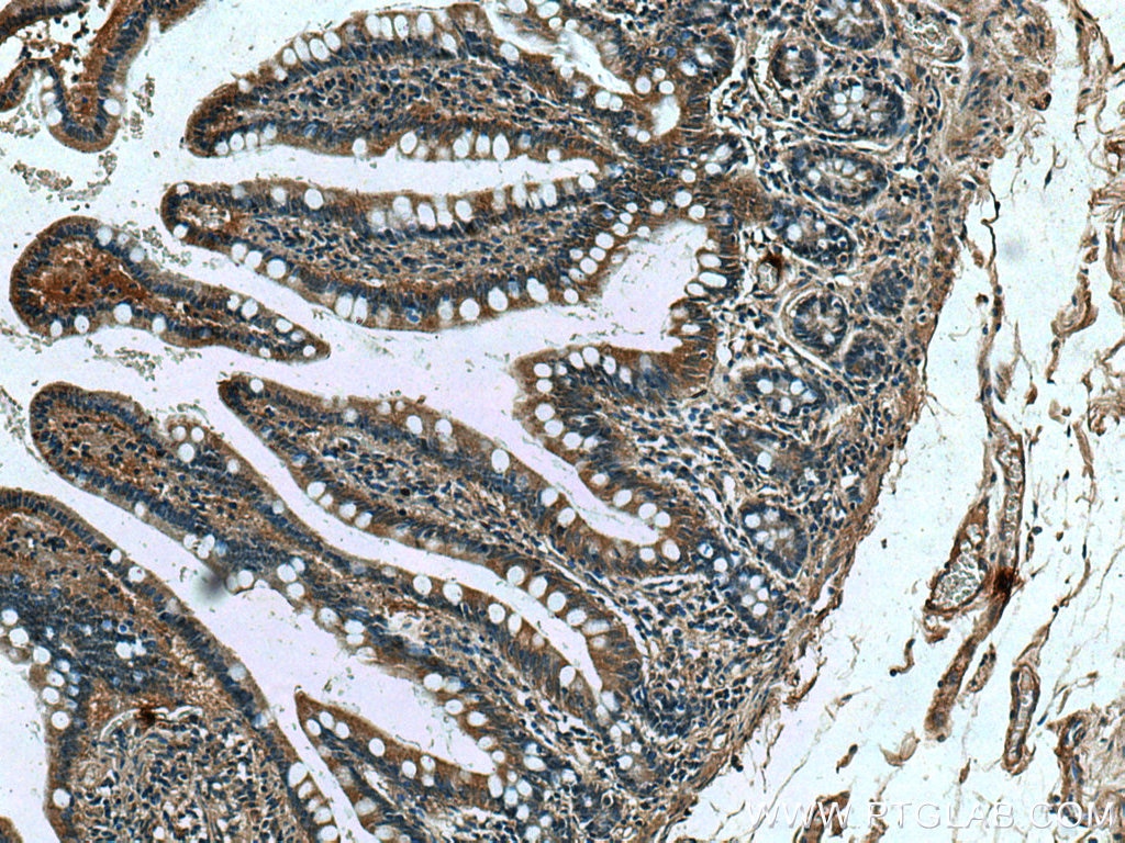 Immunohistochemistry (IHC) staining of human small intestine tissue using DEFA1 Monoclonal antibody (67156-1-Ig)