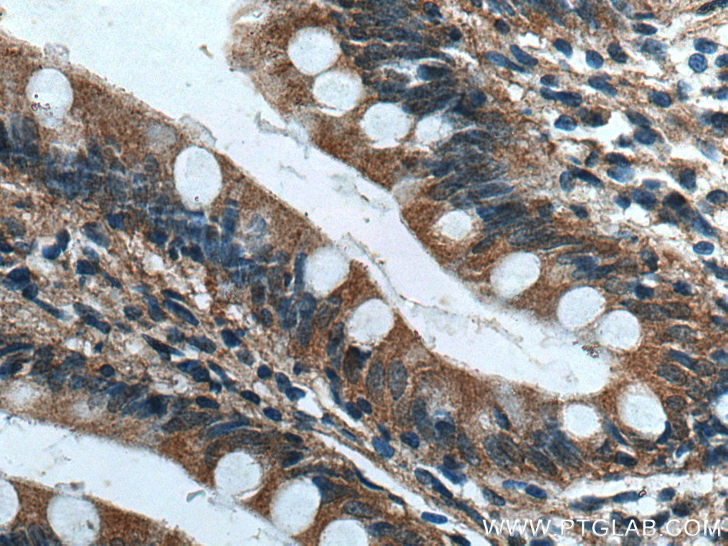 Immunohistochemistry (IHC) staining of human small intestine tissue using DEFA1 Monoclonal antibody (67156-1-Ig)