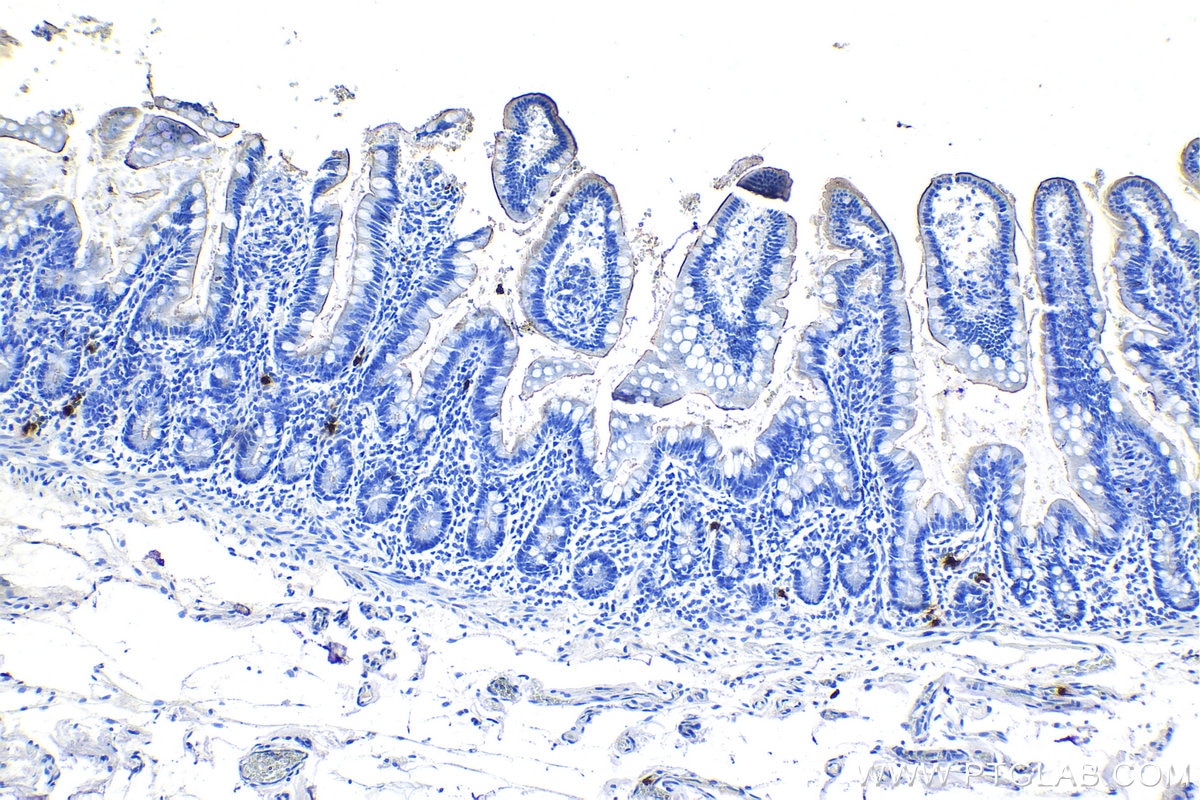 Immunohistochemistry (IHC) staining of human small intestine tissue using DEFA1 Monoclonal antibody (67156-1-Ig)