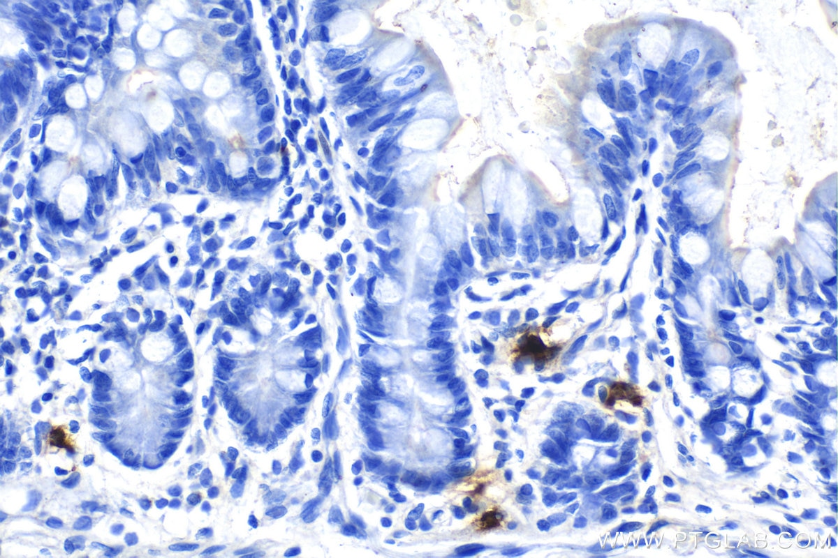 Immunohistochemistry (IHC) staining of human small intestine tissue using DEFA1 Monoclonal antibody (67156-1-Ig)