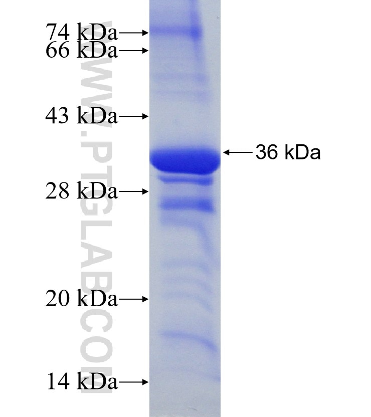 DEFA1 fusion protein Ag12592 SDS-PAGE