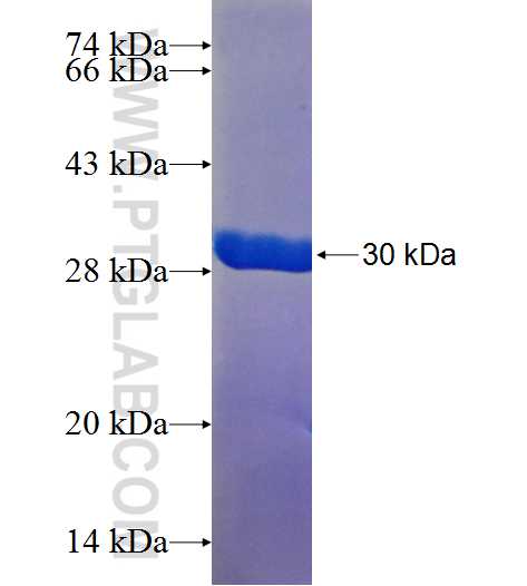 DEFA4 fusion protein Ag25547 SDS-PAGE