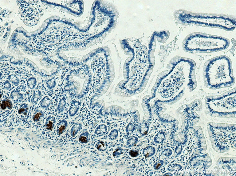 Immunohistochemistry (IHC) staining of human small intestine tissue using DEFA5 Polyclonal antibody (18268-1-AP)