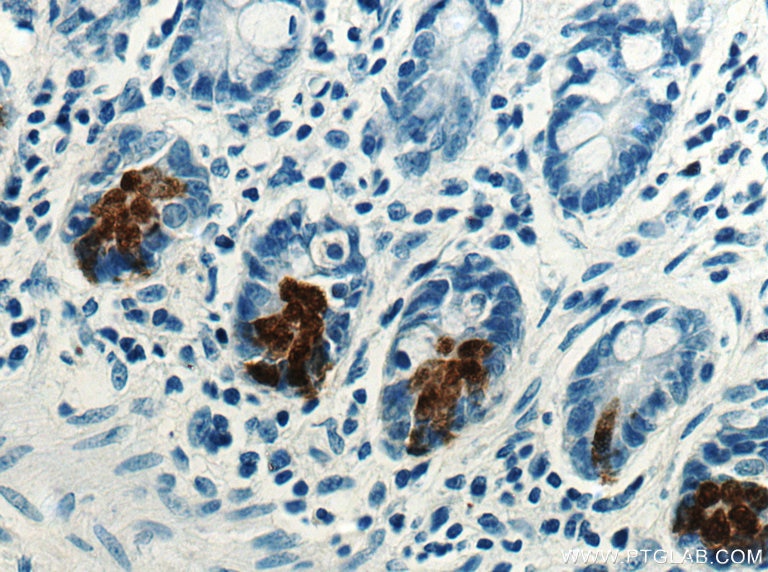 Immunohistochemistry (IHC) staining of human small intestine tissue using DEFA5 Polyclonal antibody (18268-1-AP)