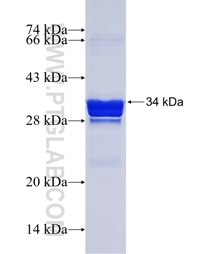 DEFA5 fusion protein Ag12793 SDS-PAGE