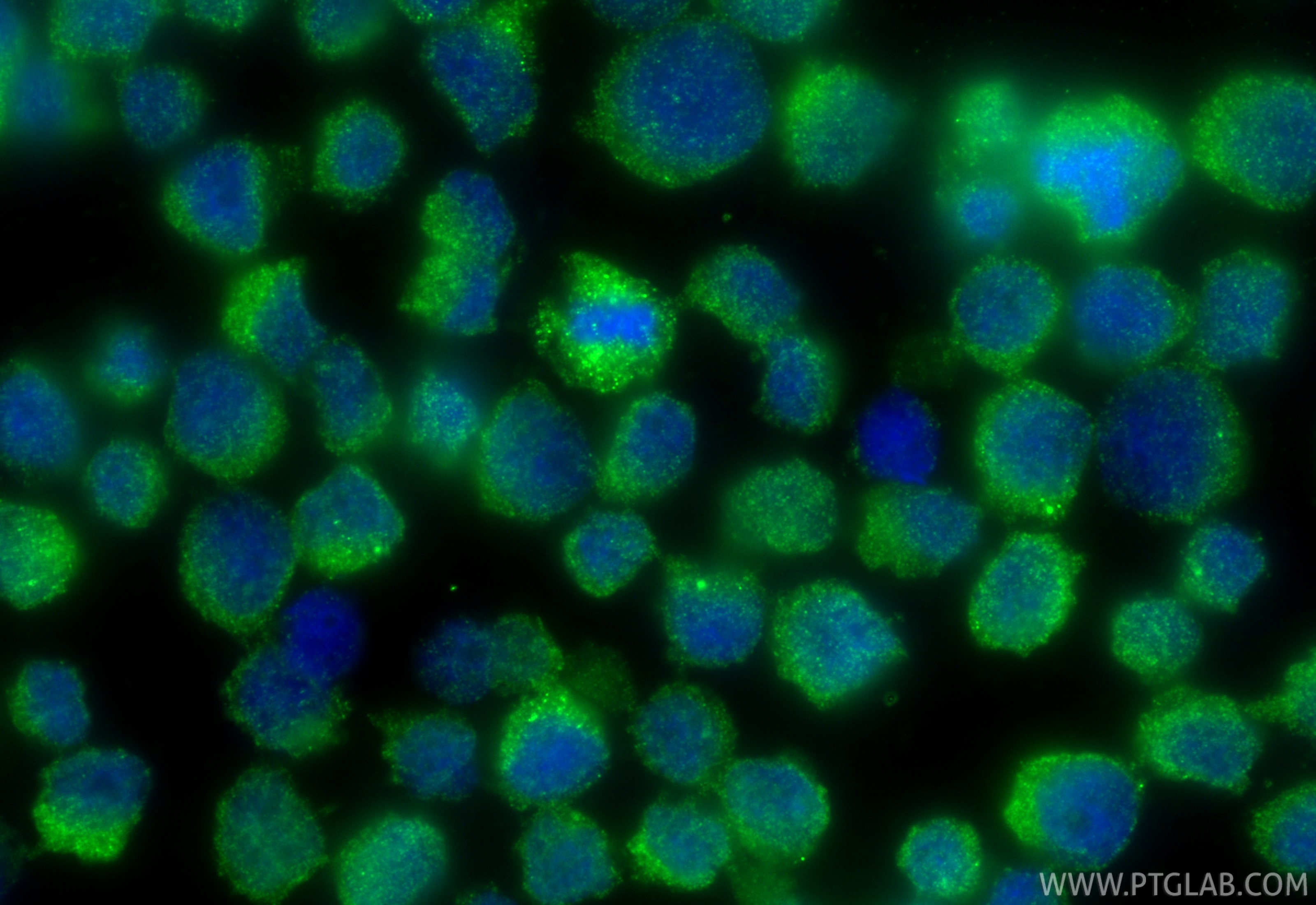 IF Staining of COLO 320 using 17923-1-AP Immunofluorescence (IF) / fluorescent staining of COLO 320 cells using DEFA6 Polyclonal antibody (17923-1-AP)