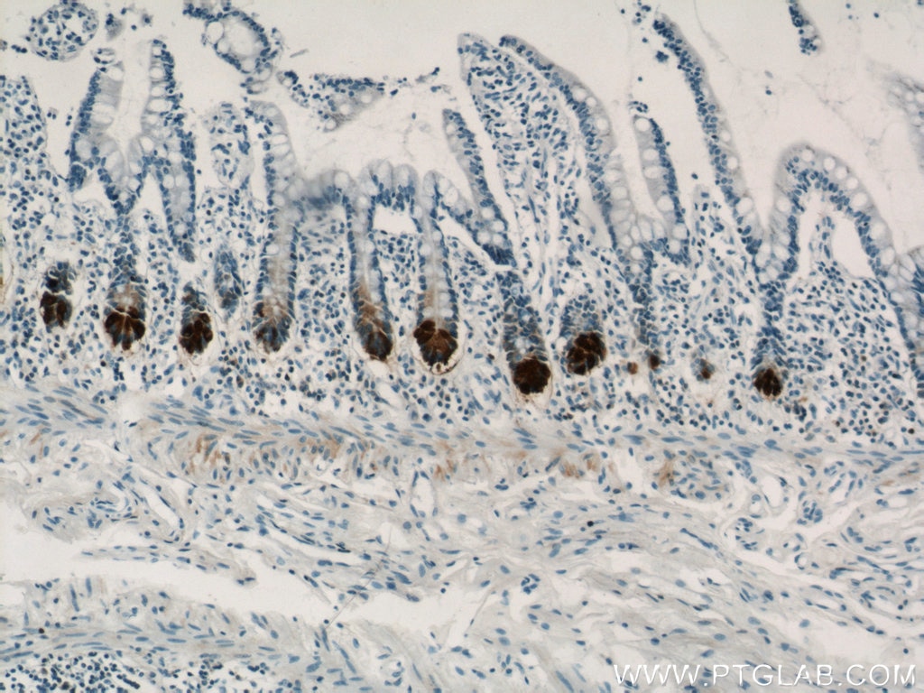 Immunohistochemistry (IHC) staining of human small intestine tissue using DEFA6 Polyclonal antibody (17923-1-AP)