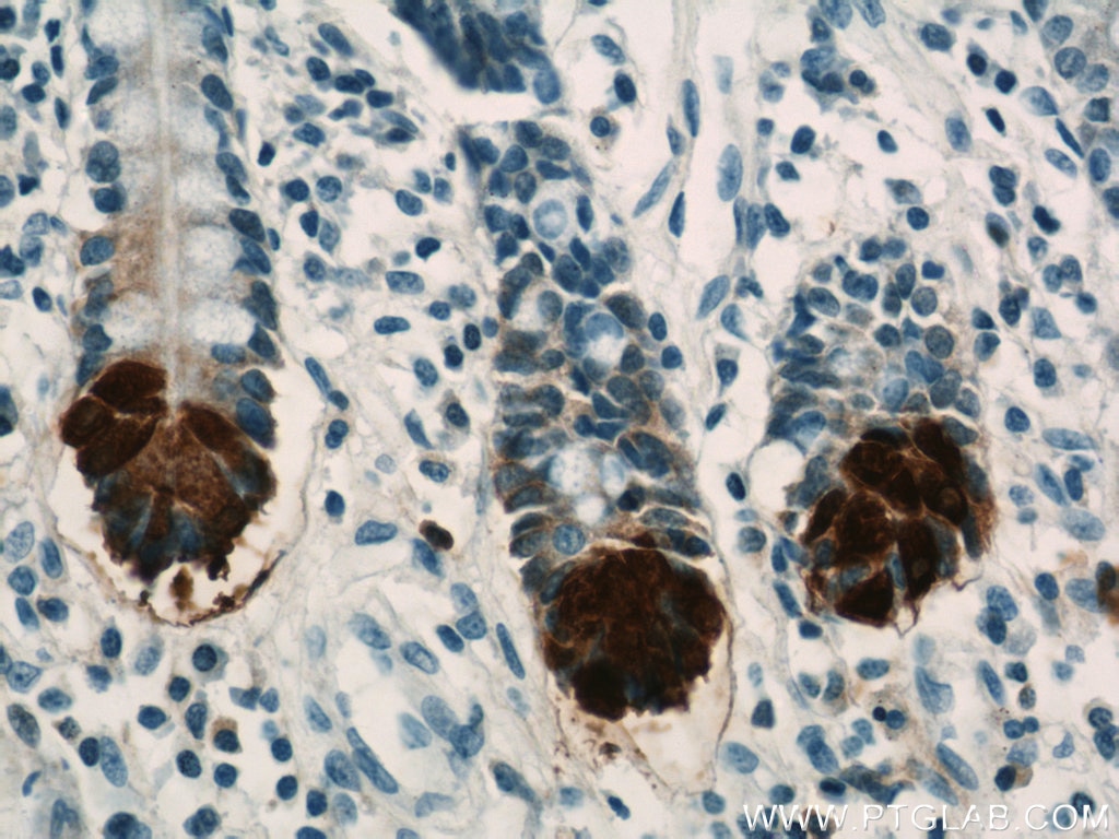 Immunohistochemistry (IHC) staining of human small intestine tissue using DEFA6 Polyclonal antibody (17923-1-AP)