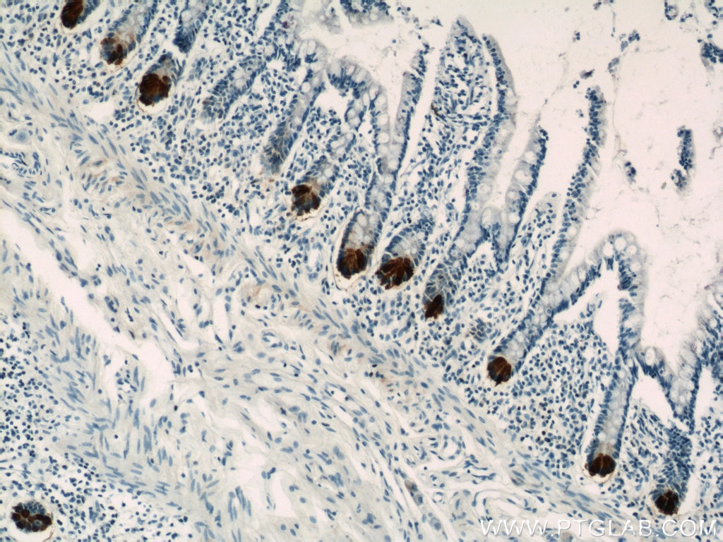 Immunohistochemistry (IHC) staining of human small intestine tissue using DEFA6 Polyclonal antibody (17923-1-AP)