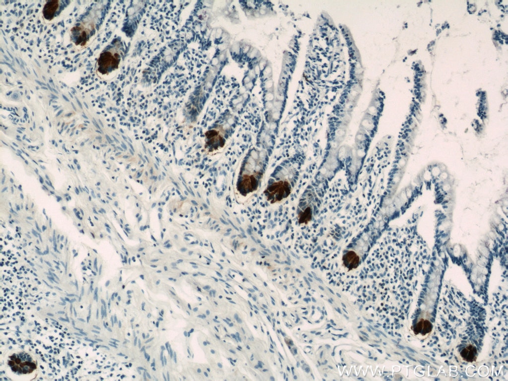 IHC staining of human small intestine using 17923-1-AP