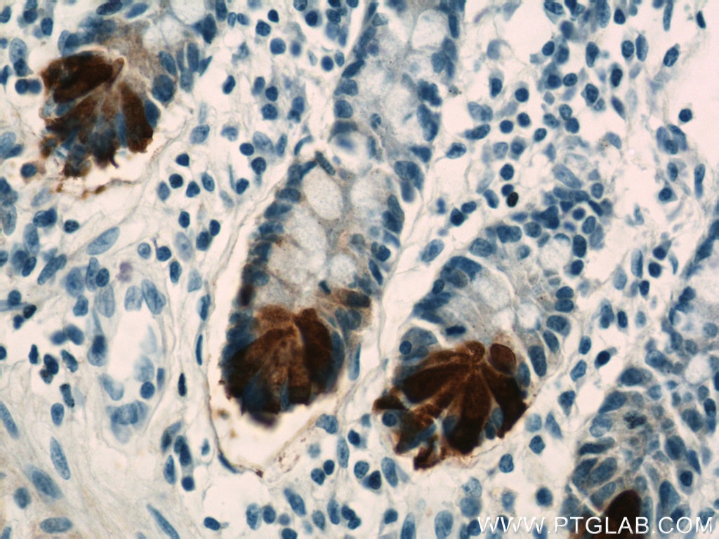 IHC staining of human small intestine using 17923-1-AP