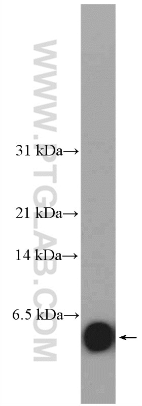 WB analysis of COLO 320 using 17923-1-AP