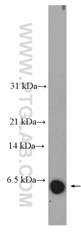 Western Blot (WB) analysis of mouse small intestine tissue using DEFA6 Polyclonal antibody (17923-1-AP)