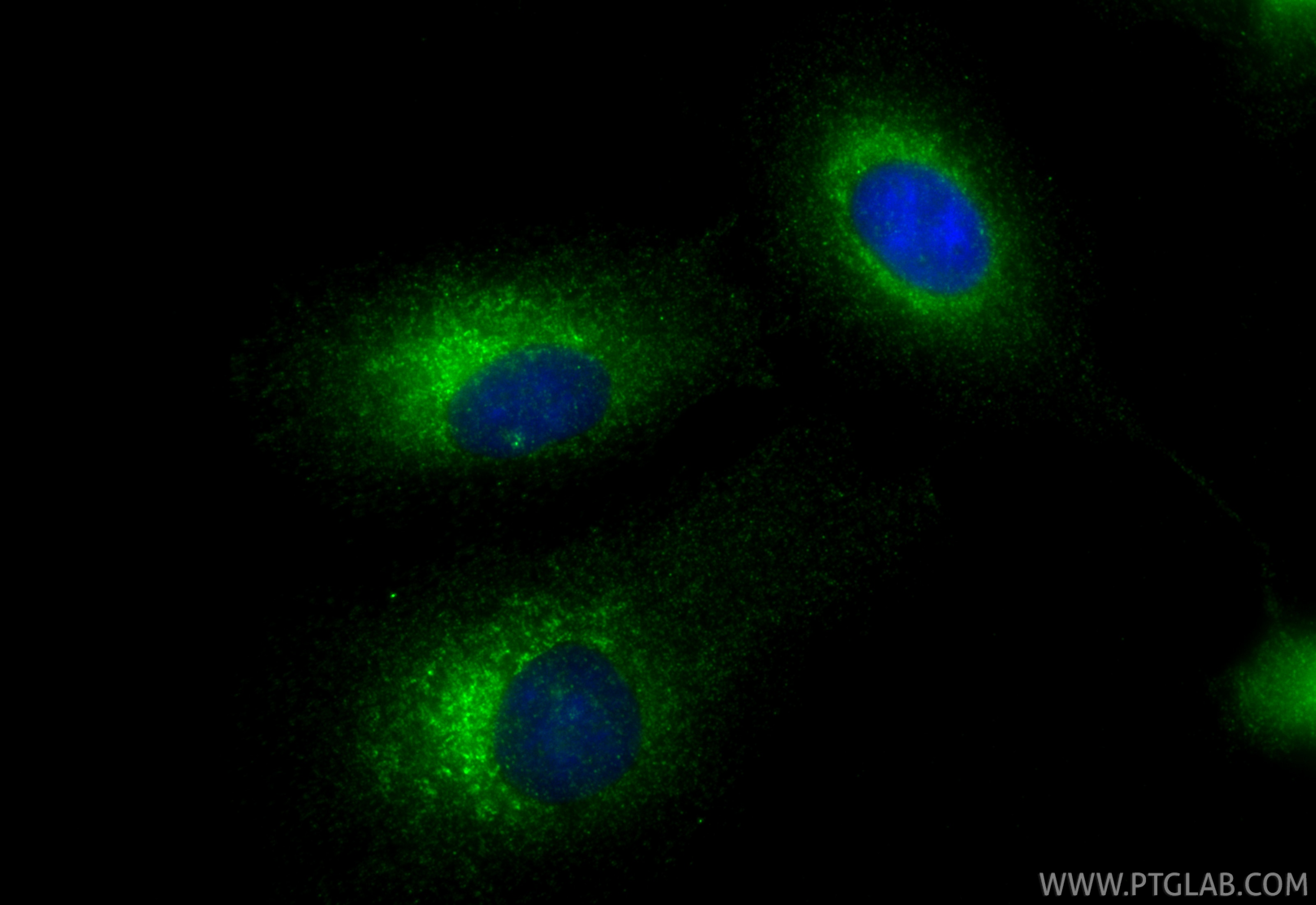 Immunofluorescence (IF) / fluorescent staining of A549 cells using DEFB1 Polyclonal antibody (14738-1-AP)