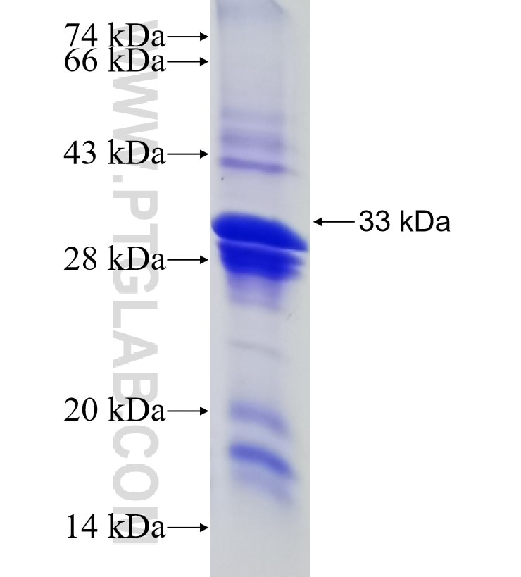 DEFB1 fusion protein Ag6406 SDS-PAGE