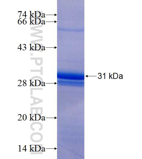 DEFB103A fusion protein Ag25940 SDS-PAGE