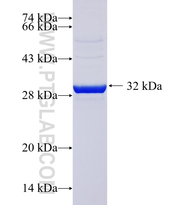 DEFB103B fusion protein Ag37439 SDS-PAGE DEFB103B fusion protein Ag37439 SDS-PAGE