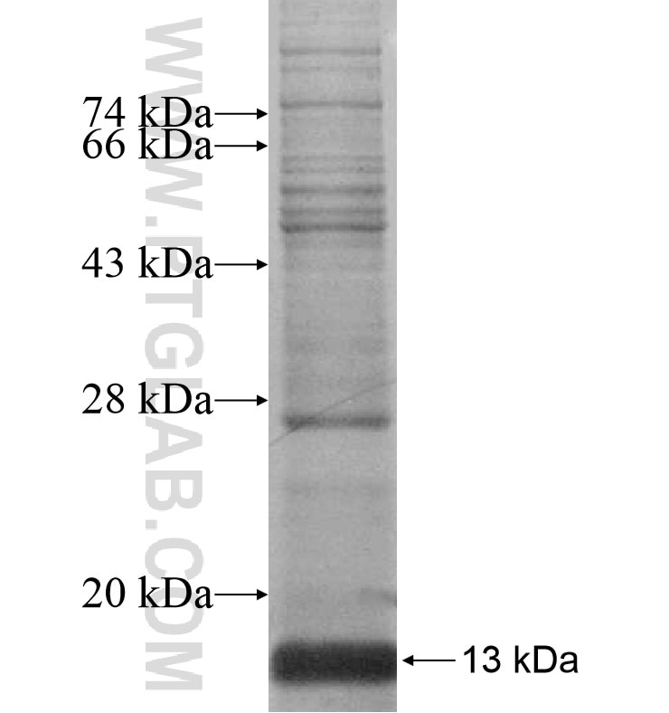 DEFB106B fusion protein Ag16755 SDS-PAGE