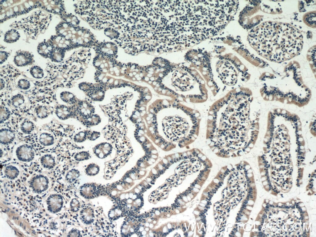 Immunohistochemistry (IHC) staining of human small intestine tissue using DEFB121 Polyclonal antibody (25761-1-AP)