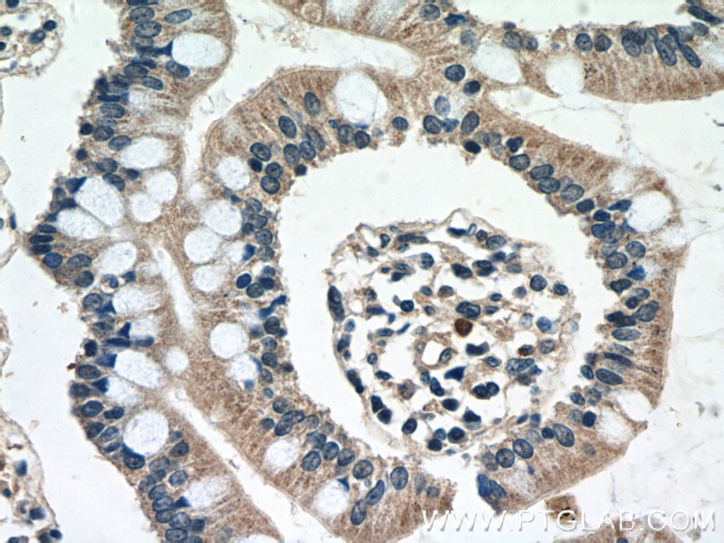 Immunohistochemistry (IHC) staining of human small intestine tissue using DEFB121 Polyclonal antibody (25761-1-AP)