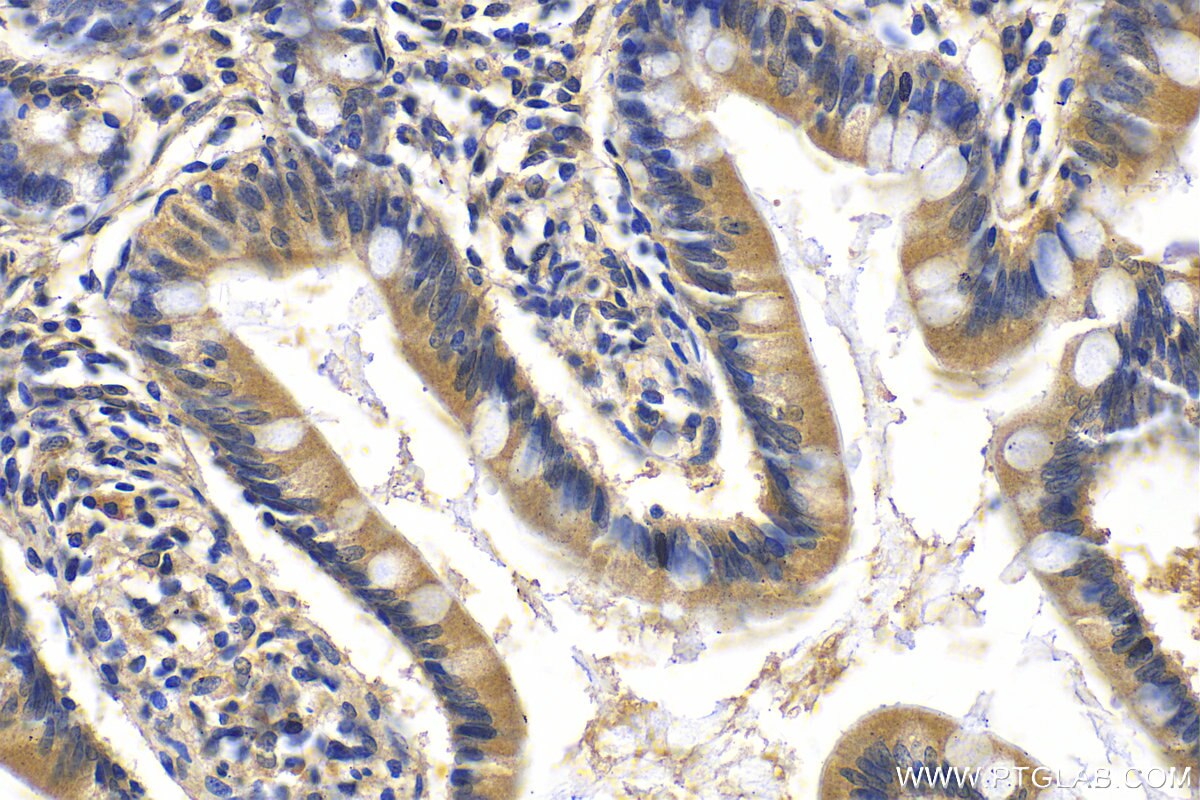 Immunohistochemistry (IHC) staining of human small intestine tissue using DEFB121 Polyclonal antibody (25761-1-AP)